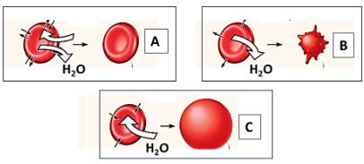 Glóbulos rojos en distintos medios acuosos