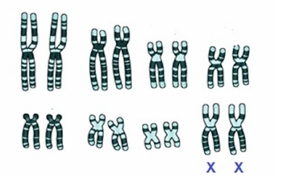 Cariotipo de mamífero